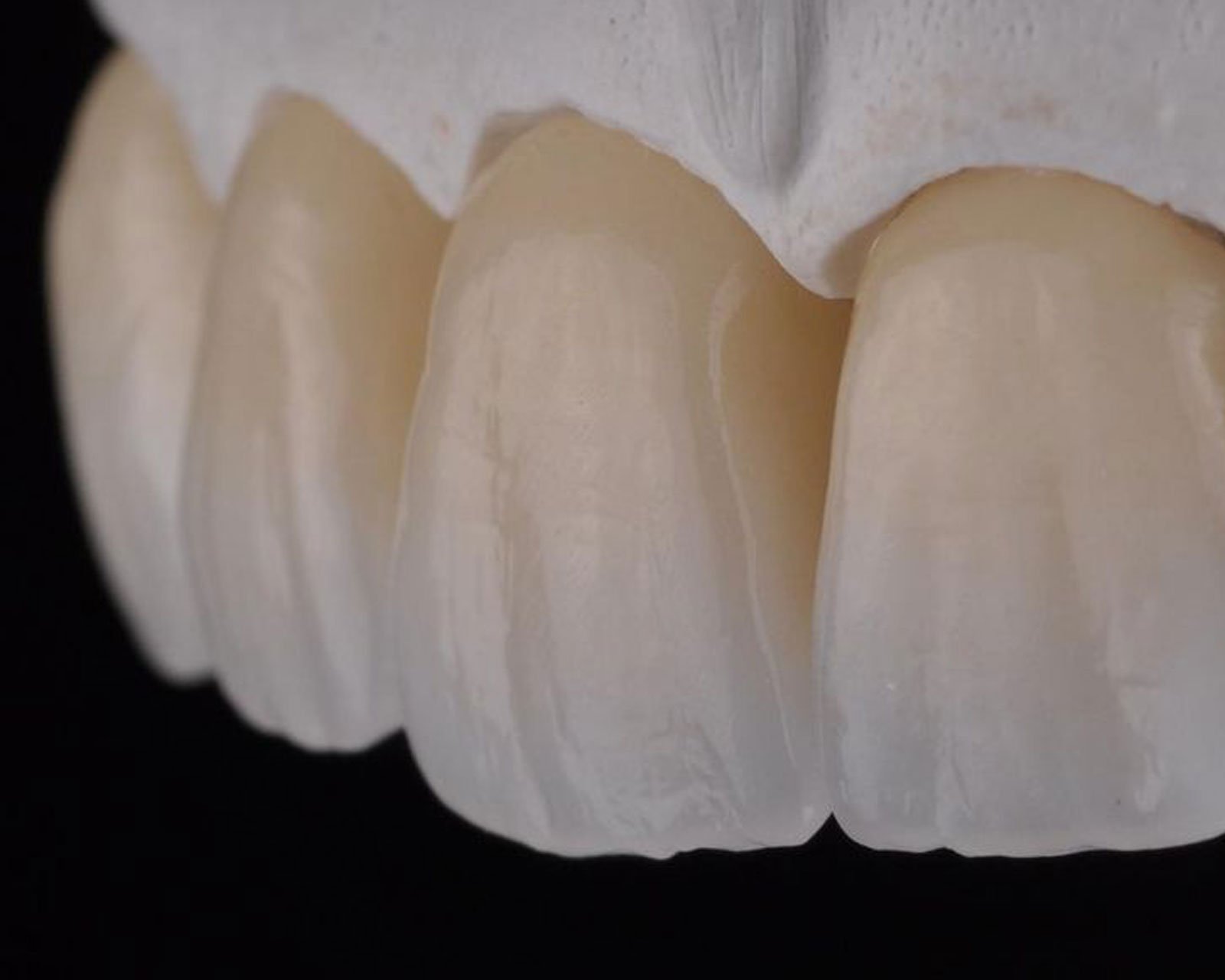Denture