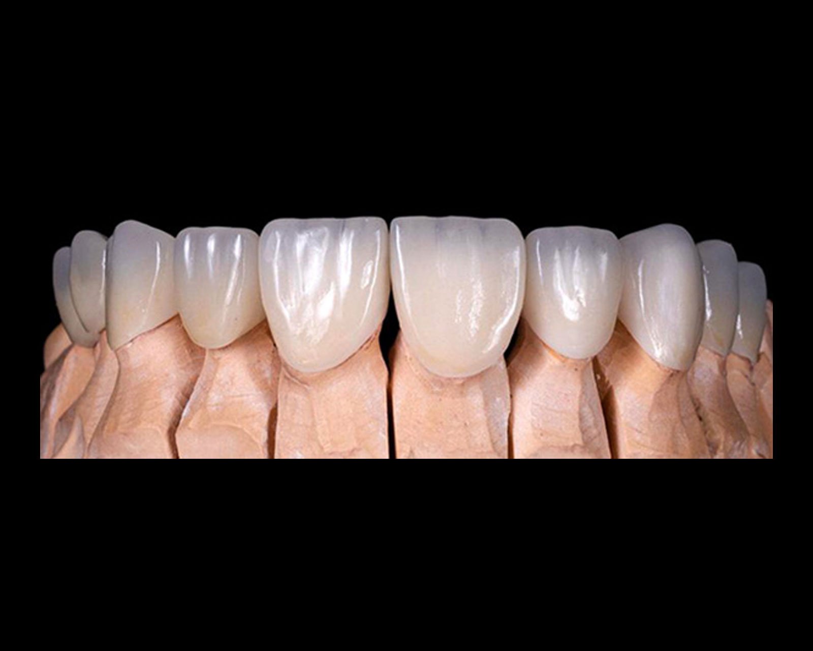 Denture