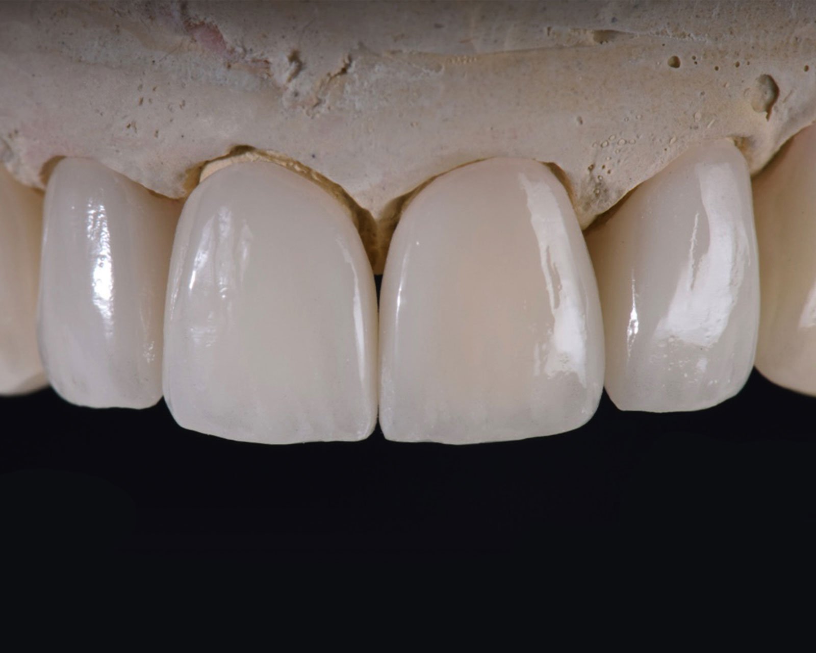 Denture